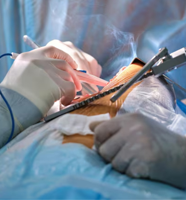 Laparoscopic Surgery